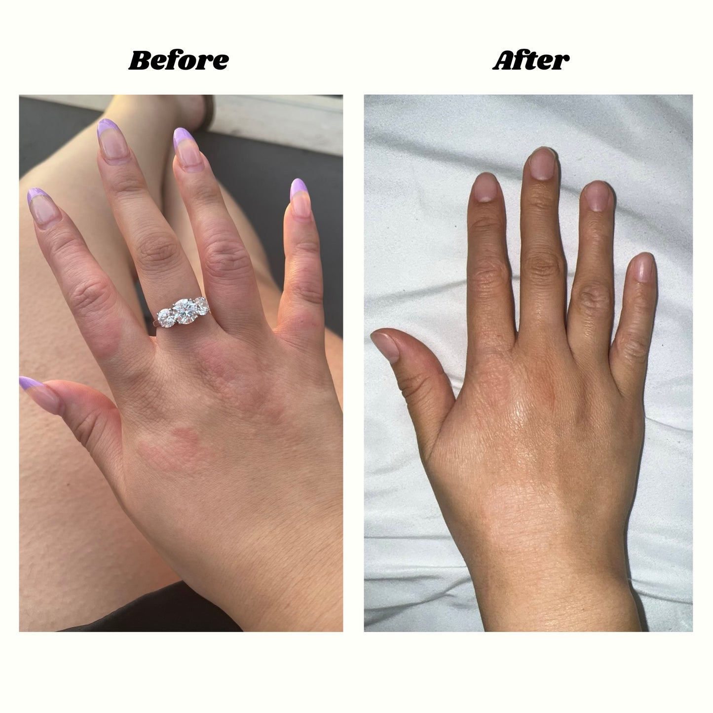 Eczema Soothing Cream