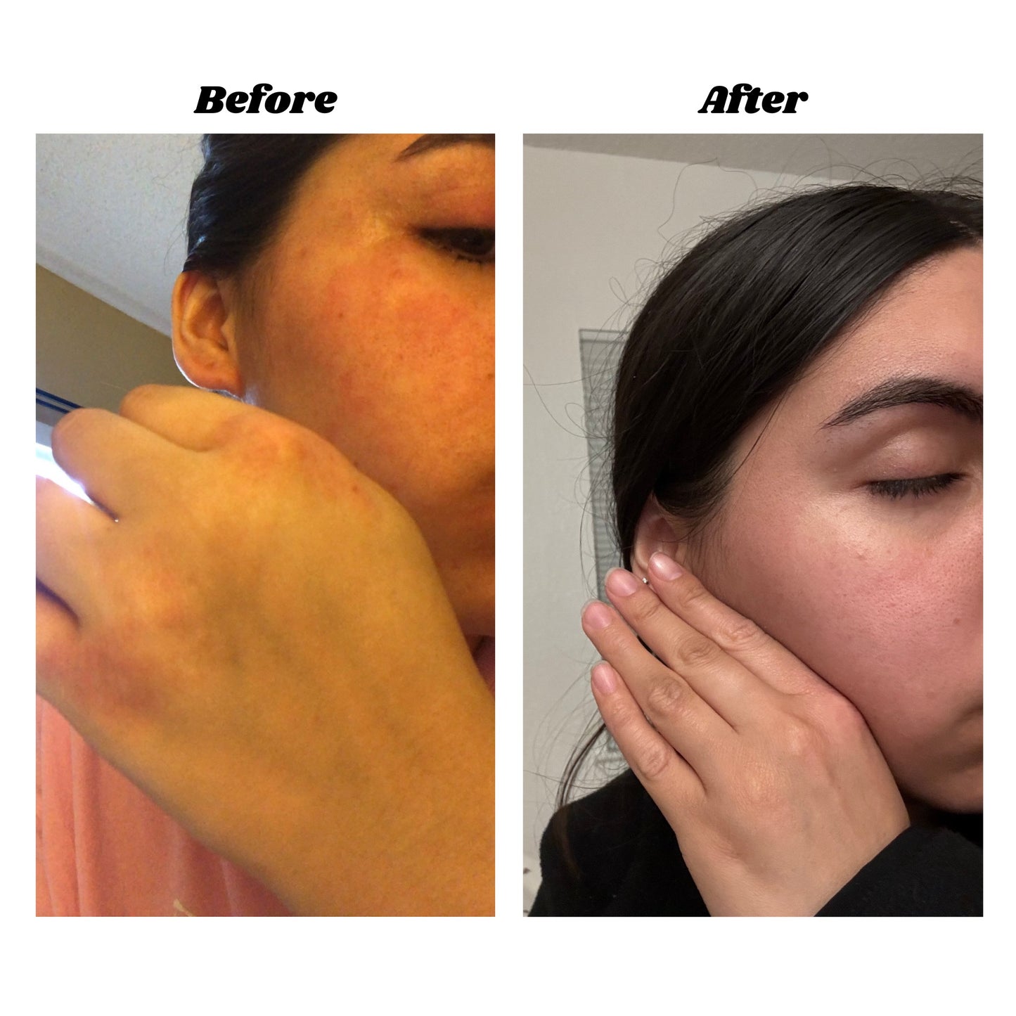 Eczema Soothing Cream